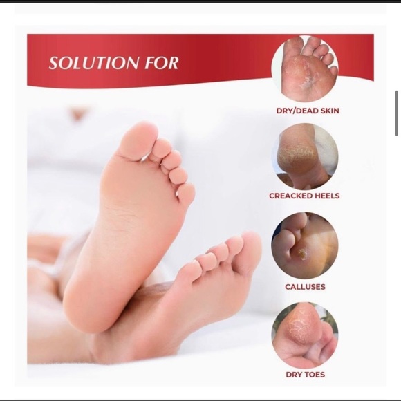Exfoliating Foot Peel Mask For Softer, Smooth Feet- Gently Peel Away Calluses - Picture 2 of 5